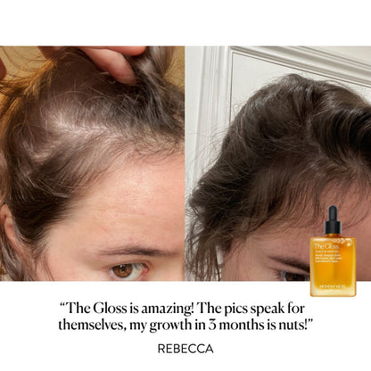 THE GLOSS - Scalp &amp; Hair Density Oil 3 x Bundle - Monday Muse